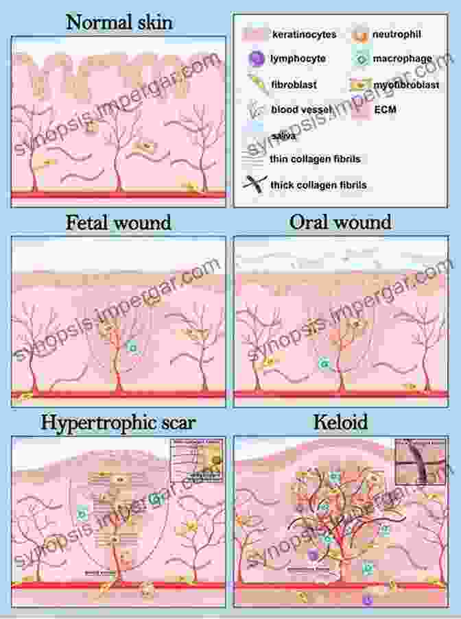 Keloid Medical Journal By Debra Bick Keloid Medical Journal Debra Bick