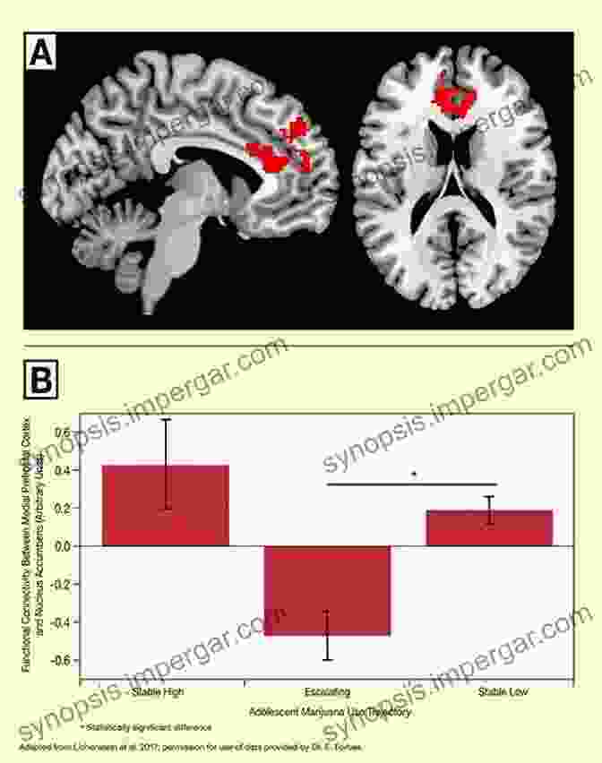 Vibrant Brain Scan Depicting Altered Neural Activity Under The Influence Of Mind Altering Drugs Mind Altering Drugs: The Science Of Subjective Experience