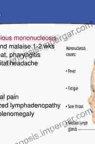 Infectious Mononucleosis (Clinical Topics In Infectious Disease)