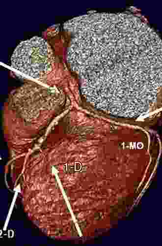 Coronary Imaging And Physiology Rachael Johns